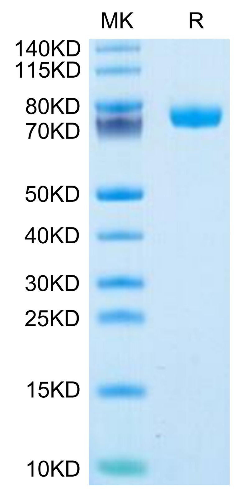 Human FcRH6 on Tris-Bis PAGE under reduced condition. The purity is greater than 95%.