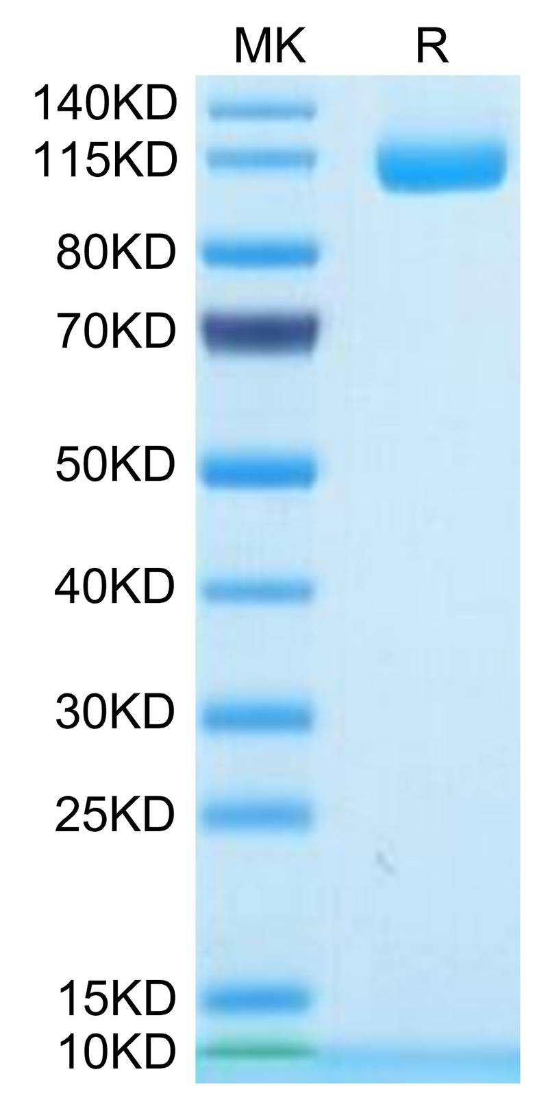 Human ENPP-1 on Tris-Bis PAGE under reduced condition. The purity is greater than 95%.