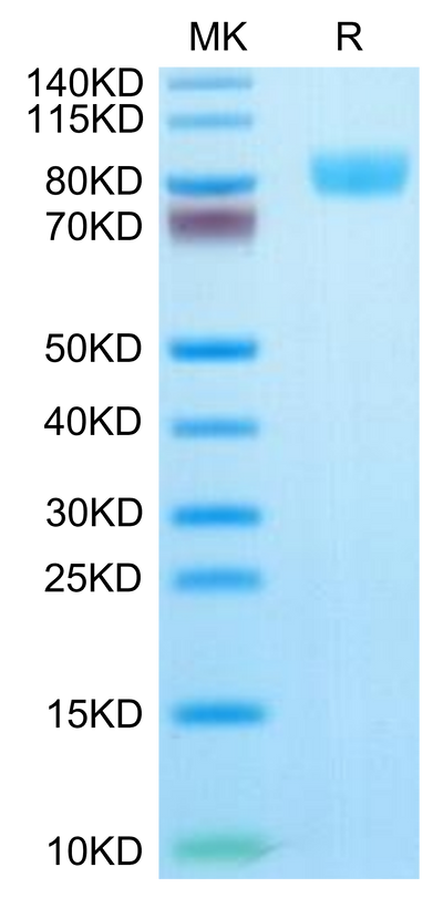 Human IL-17R alpha on Tris-Bis PAGE under reduced condition. The purity is greater than 95%.