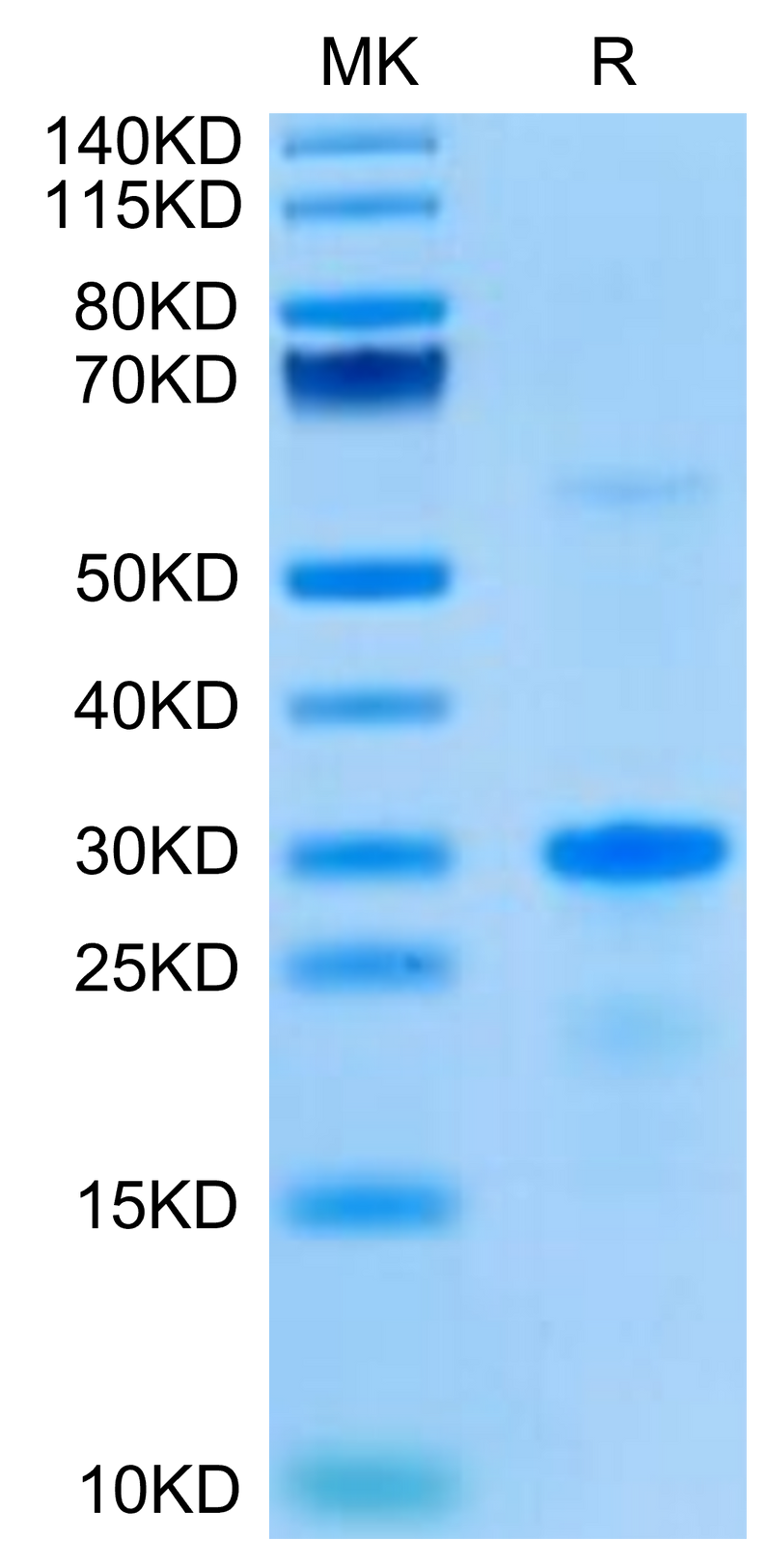 Human EGFL7 on Tris-Bis PAGE under reduced condition. The purity is greater than 95%.