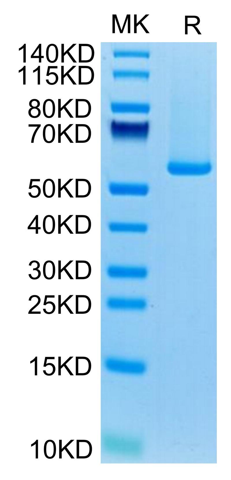 Biotinylated Human GUCY2C on Tris-Bis PAGE under reduced condition. The purity is greater than 95%.