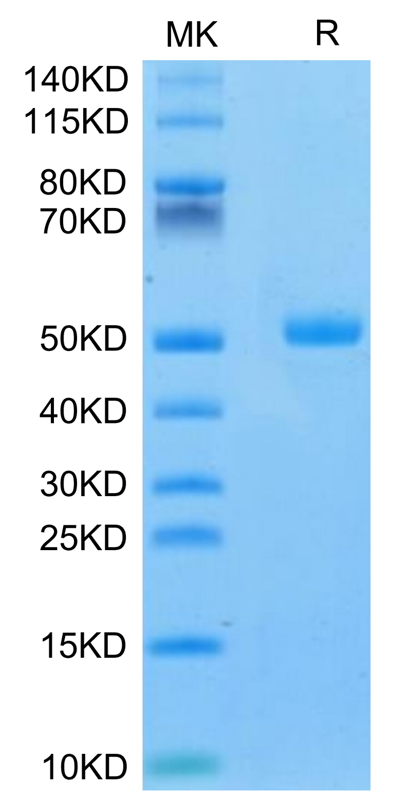 Mouse CA9 on Tris-Bis PAGE under reduced condition. The purity is greater than 95%.