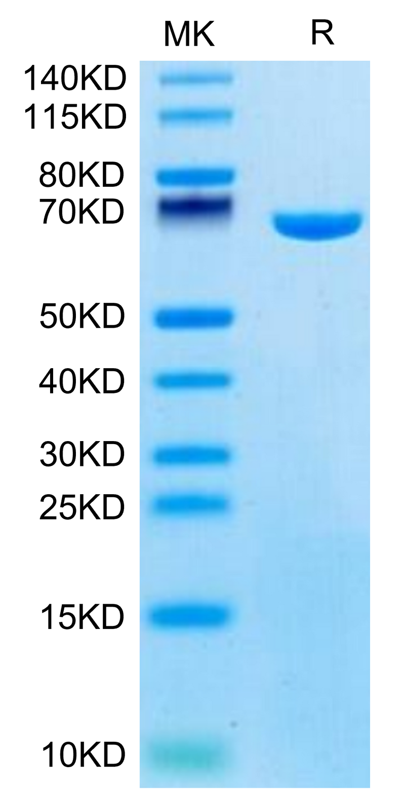 Mouse Serum Albumin on Tris-Bis PAGE under reduced condition. The purity is greater than 95%.