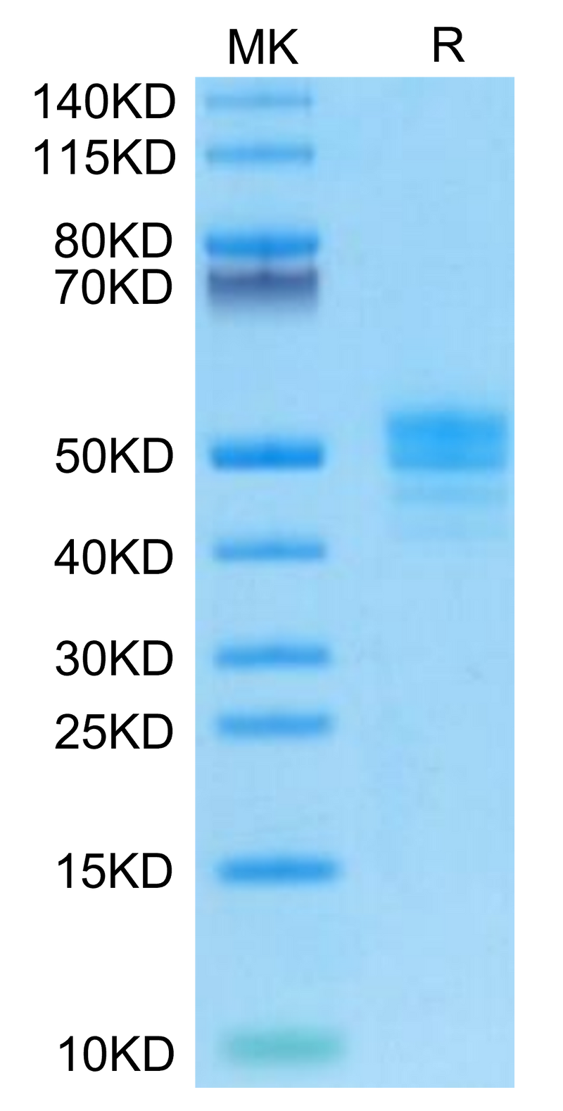 Human CD14 on Tris-Bis PAGE under reduced condition. The purity is greater than 95%.