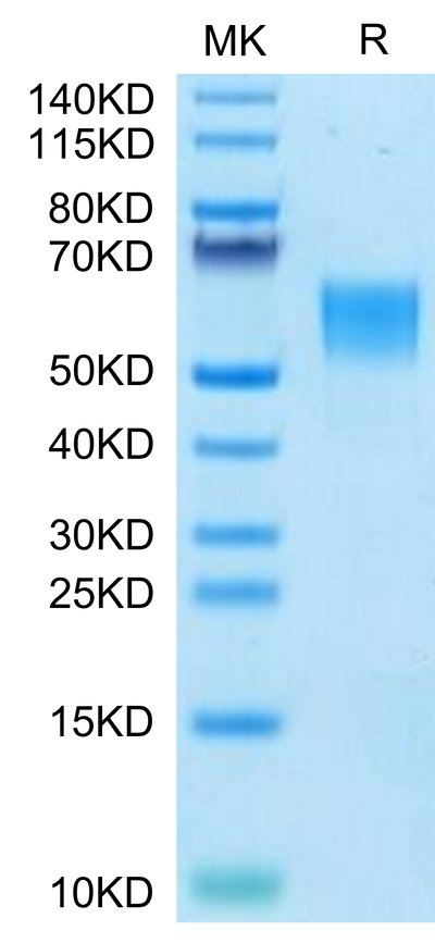 Human ENPP-3 (558-875) on Tris-Bis PAGE under reduced condition. The purity is greater than 95%.