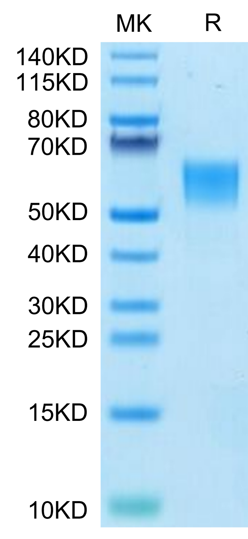 Human ENPP-3 (558-875) on Tris-Bis PAGE under reduced condition. The purity is greater than 95%.