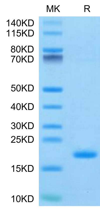 Human ENPP-3 (48-157) on Tris-Bis PAGE under reduced condition. The purity is greater than 95%.