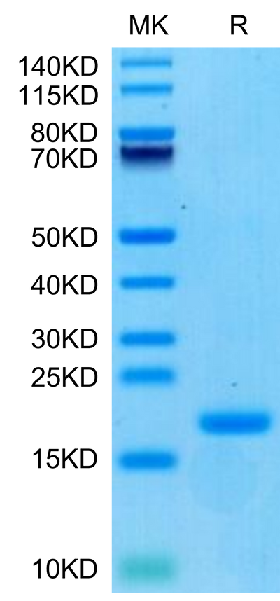 Biotinylated Human ENPP-3 (48-157) on Tris-Bis PAGE under reduced condition. The purity is greater than 95%.