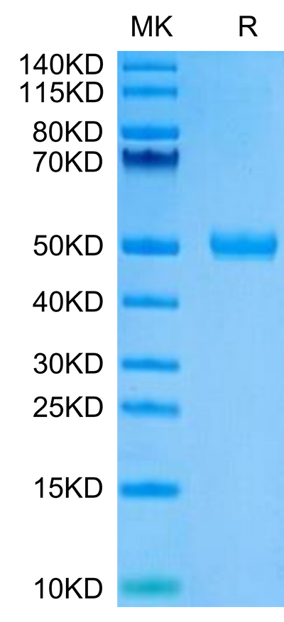 Human CYTL1 on Tris-Bis PAGE under reduced condition. The purity is greater than 95%.