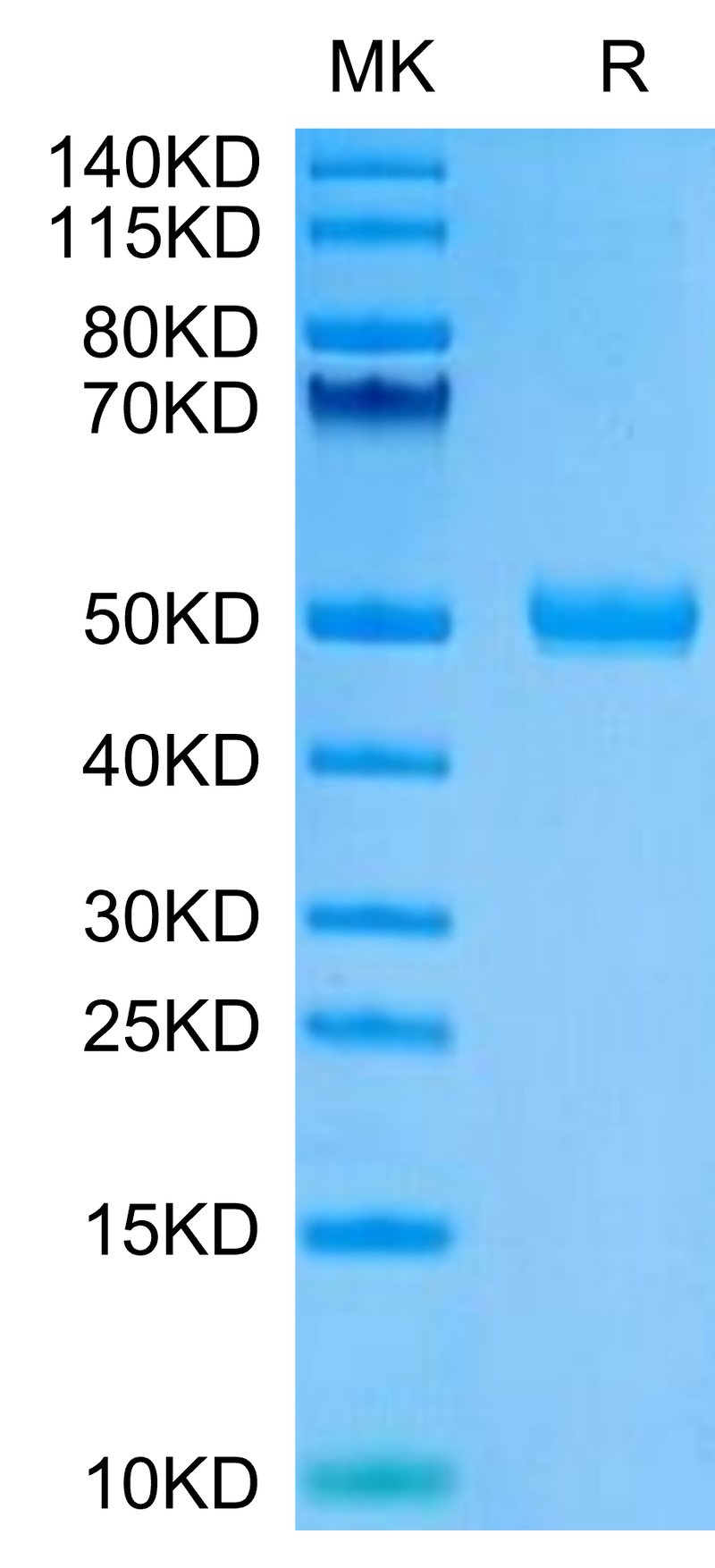 Human CYTL1 on Tris-Bis PAGE under reduced condition. The purity is greater than 95%.