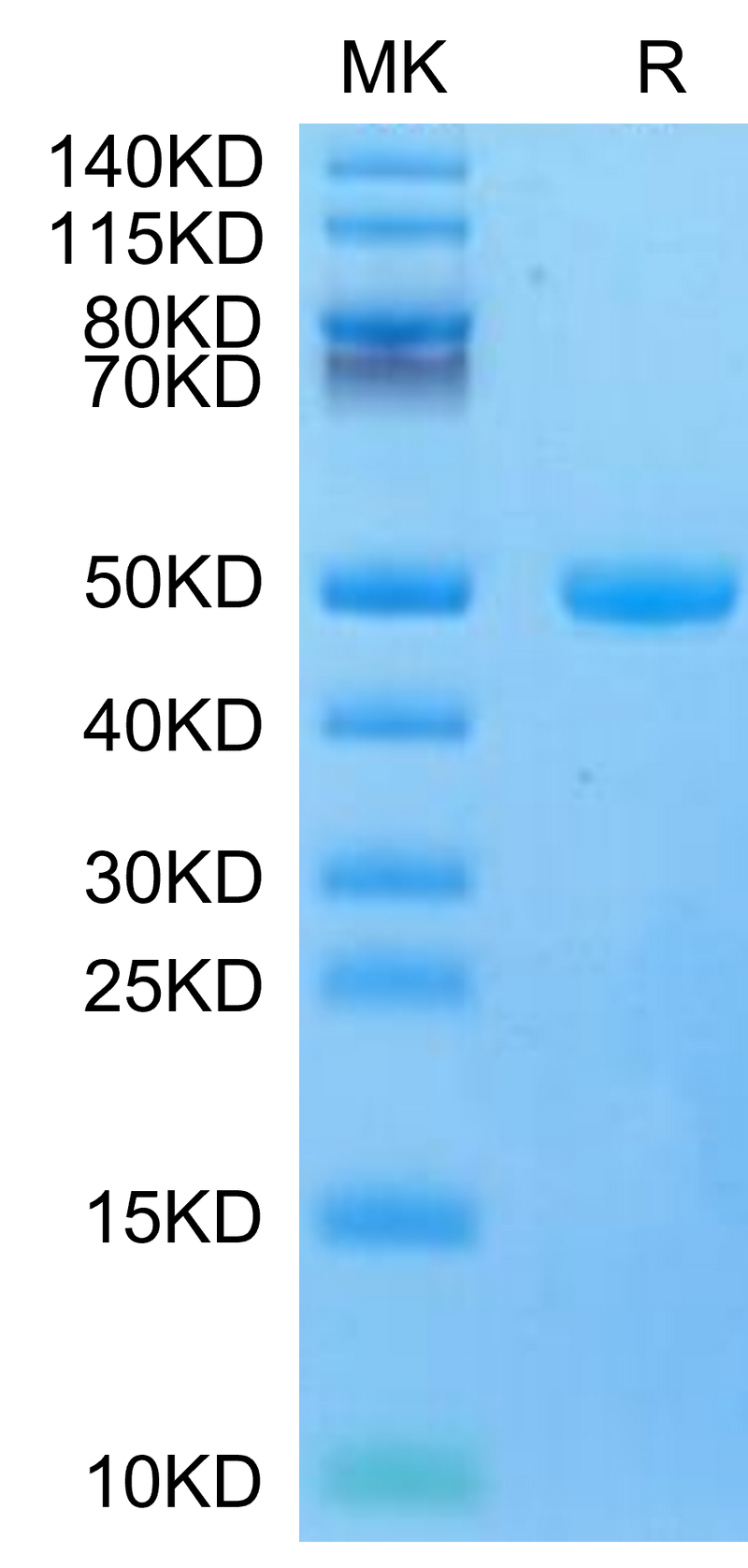 Mouse CYTL1 on Tris-Bis PAGE under reduced condition. The purity is greater than 95%.