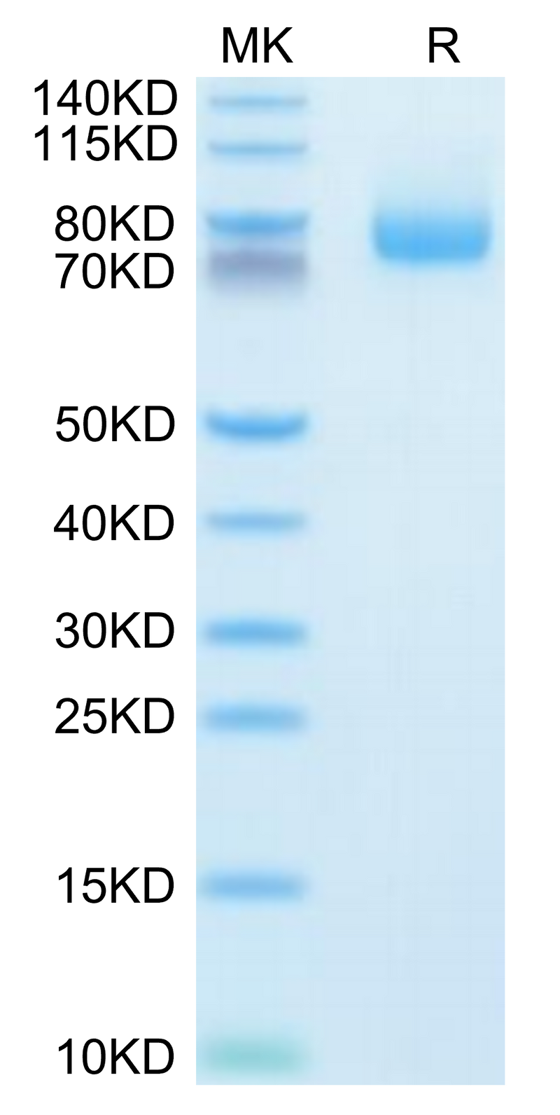 Human GITR Ligand (Trimer) on Tris-Bis PAGE under reduced condition. The purity is greater than 95%.