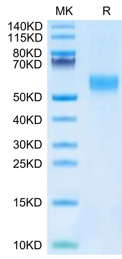 Mouse FGFR3 alpha (IIIb) on Tris-Bis PAGE under reduced condition. The purity is greater than 95%.