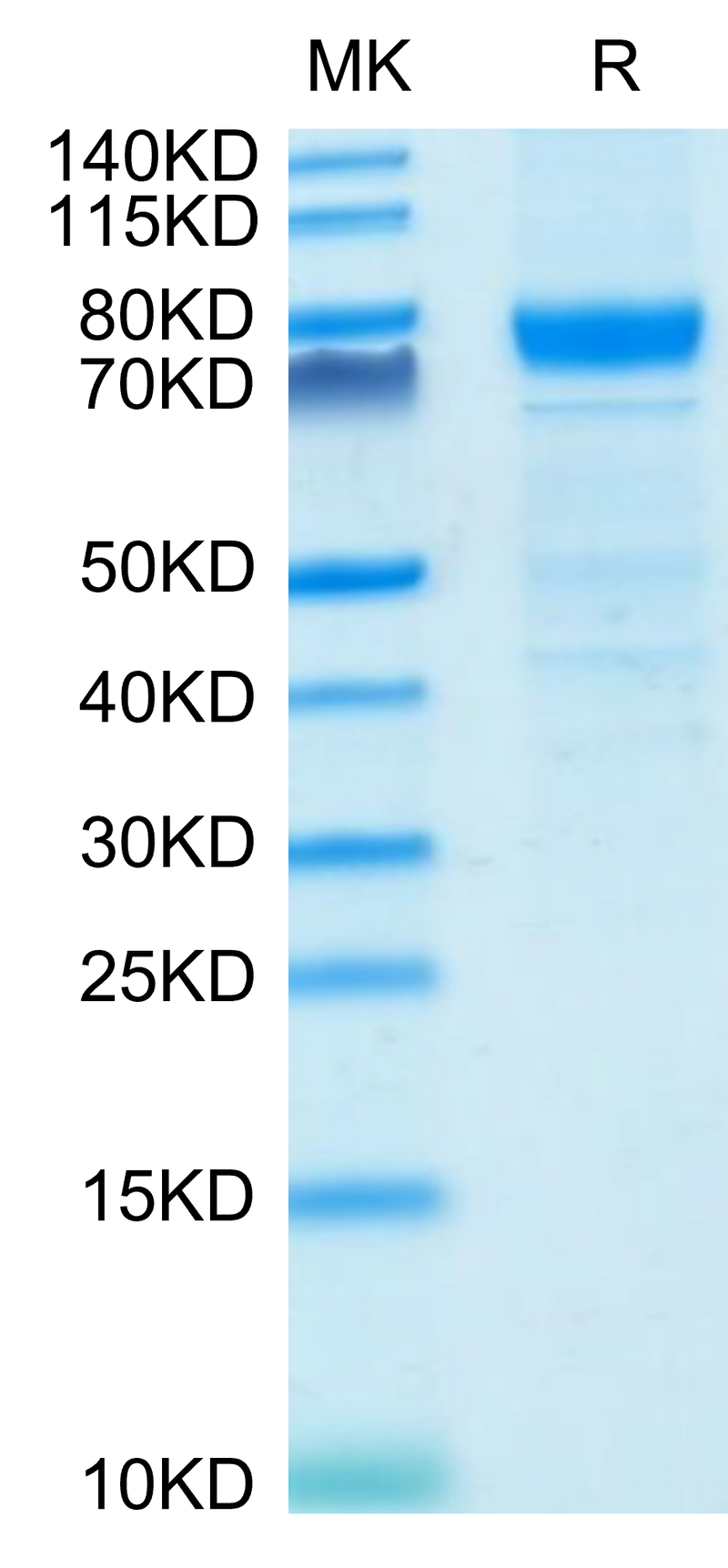 Human IL-3 R alpha on Tris-Bis PAGE under reduced condition. The purity is greater than 90%.