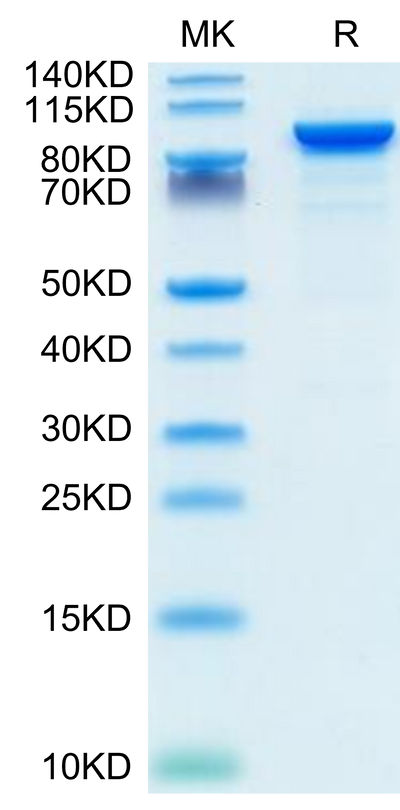 Mouse ENPP-2 on Tris-Bis PAGE under reduced condition. The purity is greater than 95%.