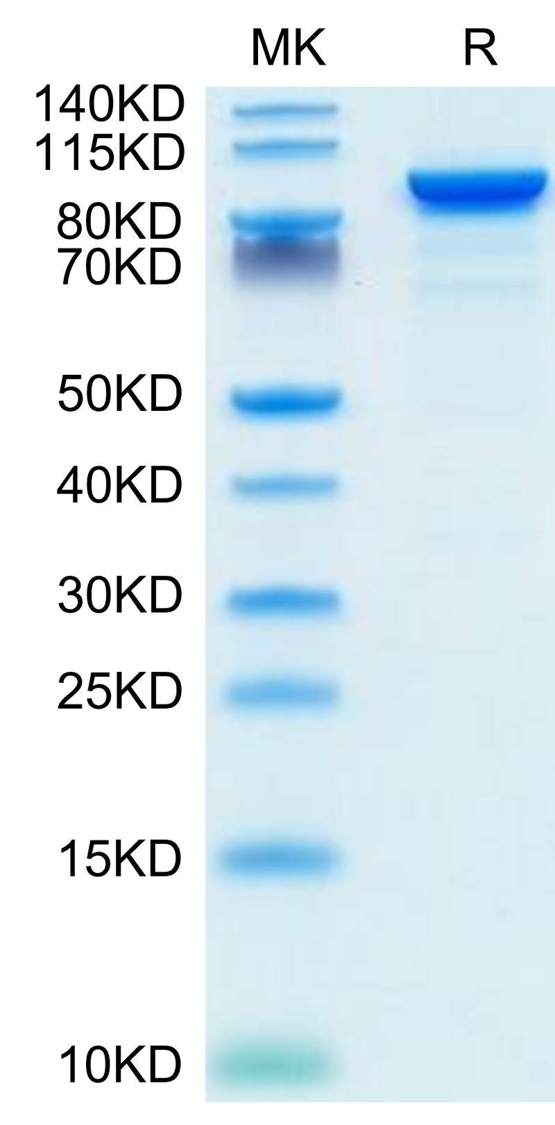 Mouse ENPP-2 on Tris-Bis PAGE under reduced condition. The purity is greater than 95%.