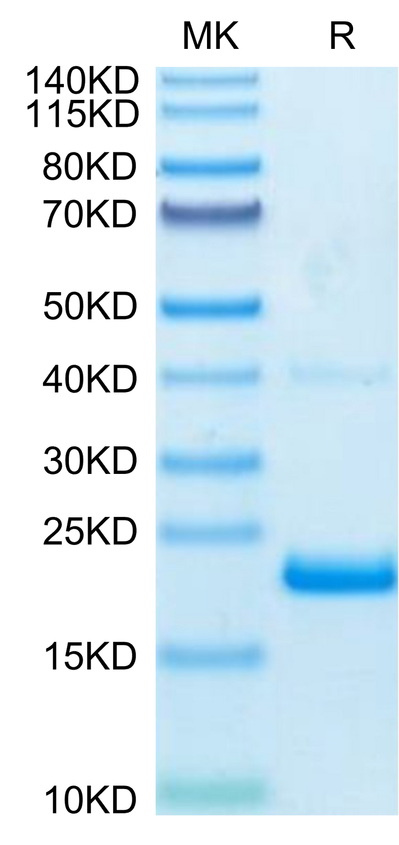 Biotinylated Human TNF alpha on Tris-Bis PAGE under reduced condition. The purity is greater than 95%.