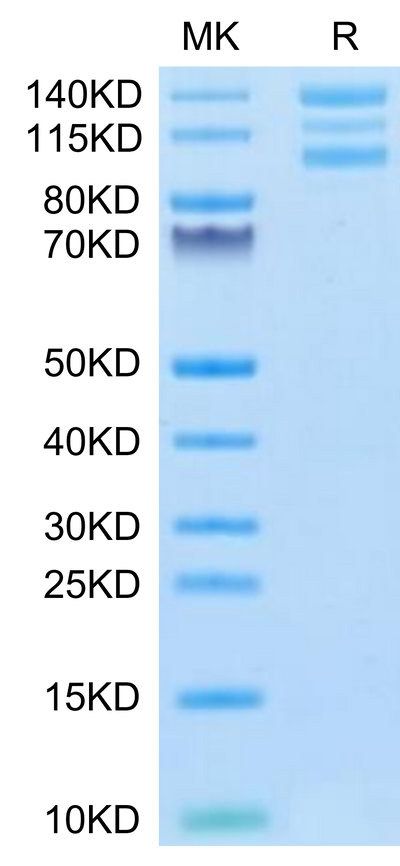 Human ITGAV&ITGB6 on Tris-Bis PAGE under reduced conditions. The purity is greater than 95%.