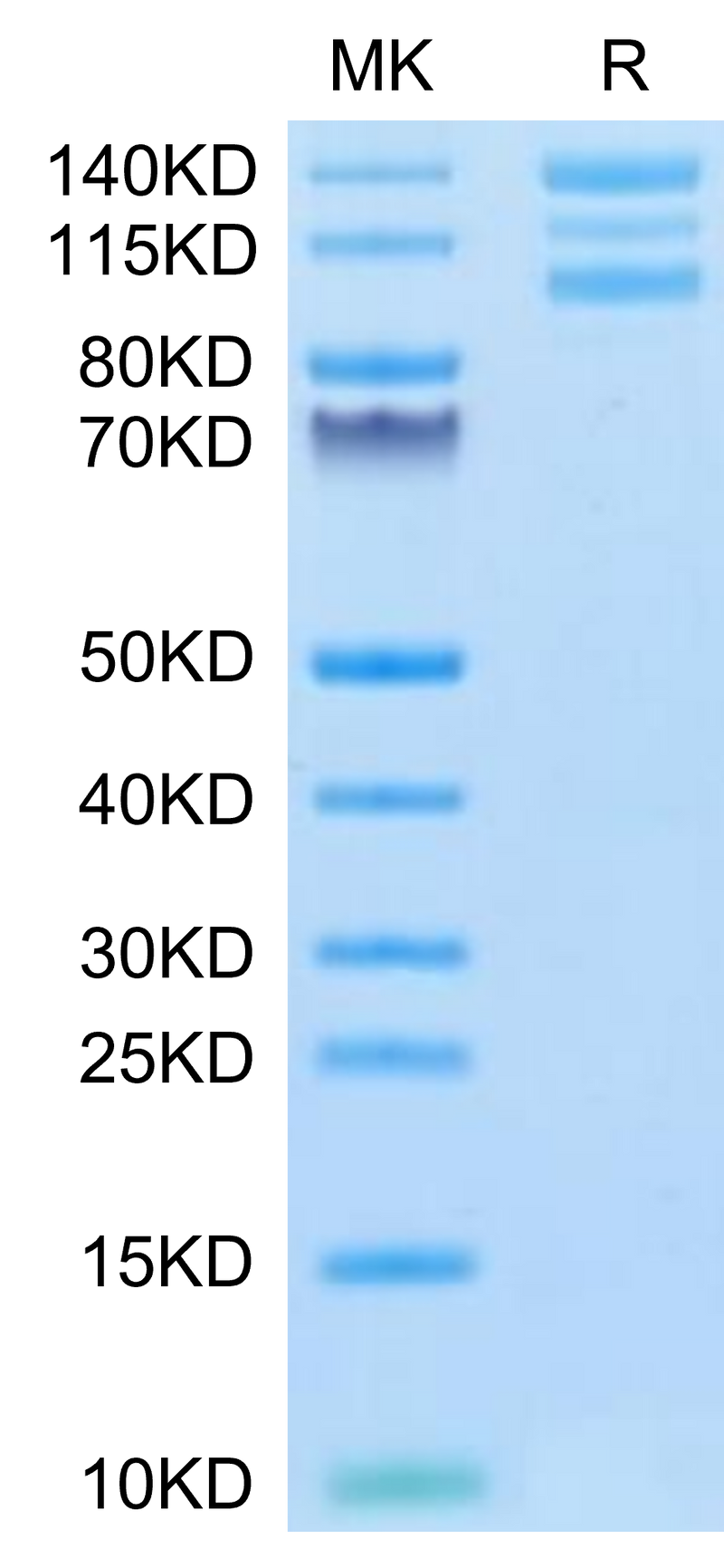 Human ITGAV&ITGB6 on Tris-Bis PAGE under reduced conditions. The purity is greater than 95%.