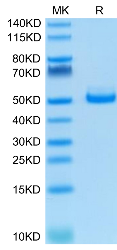 Human TIGIT on Tris-Bis PAGE under reduced condition. The purity is greater than 95%.