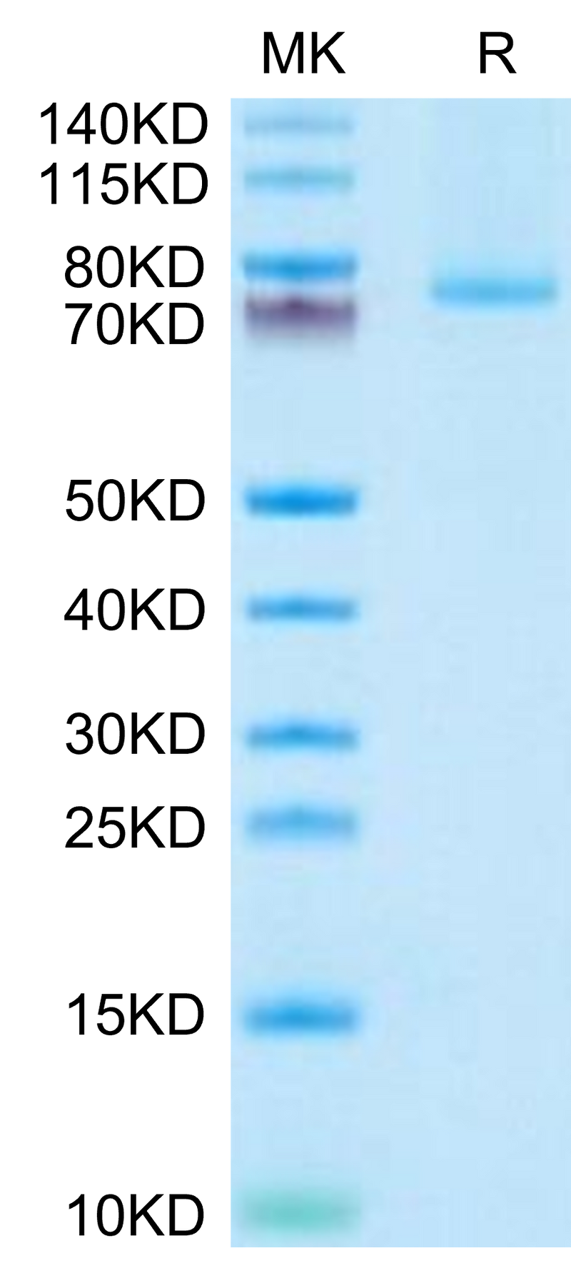 Human 4-1BB Ligand (Trimer) on Tris-Bis PAGE under reduced condition. The purity is greater than 95%.