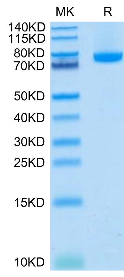 Human BAFF (Trimer) on Tris-Bis PAGE under reduced condition. The purity is greater than 95%.