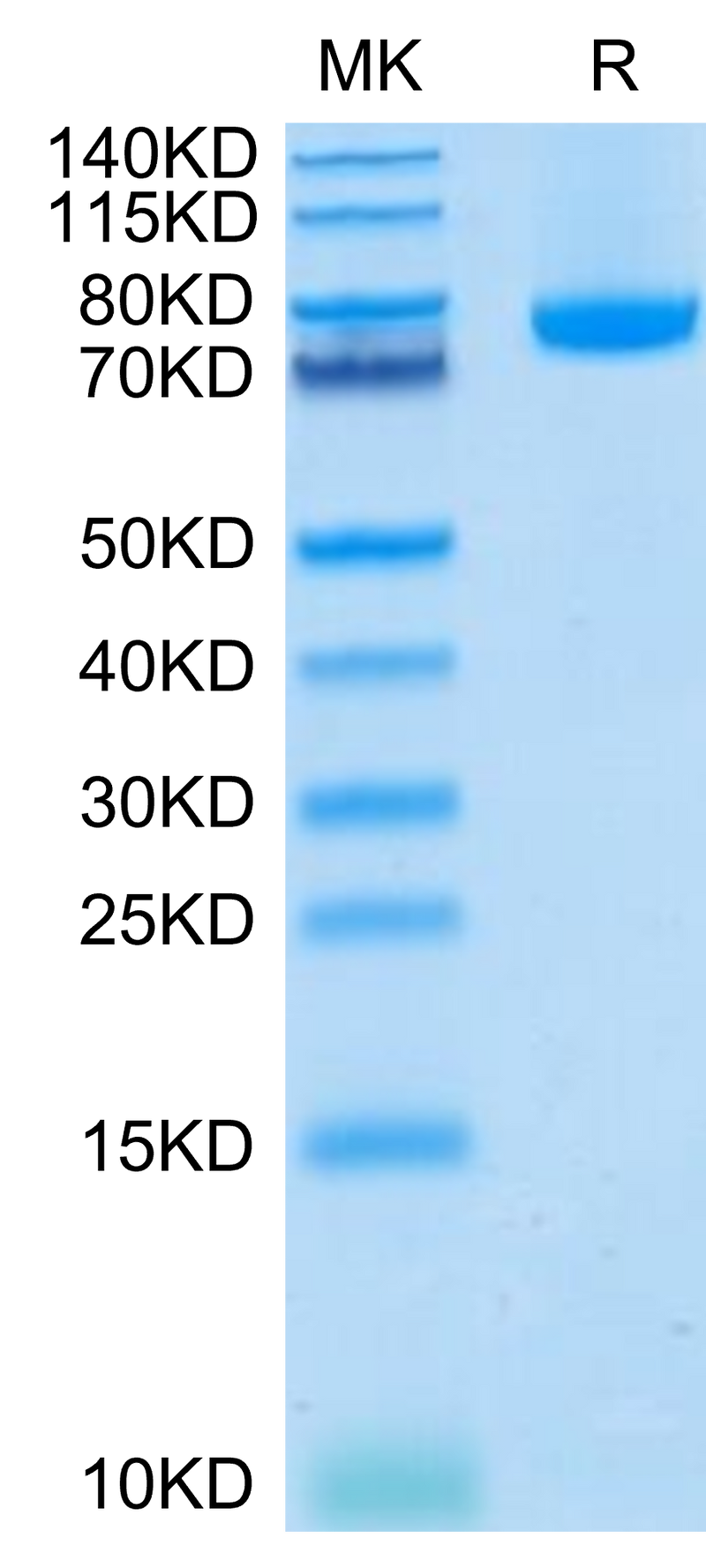 Human BAFF (Trimer) on Tris-Bis PAGE under reduced condition. The purity is greater than 95%.