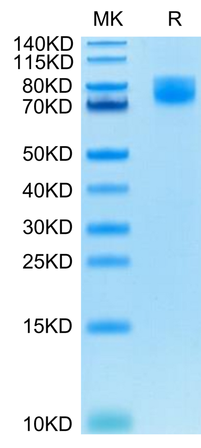 Human B7-2 on Tris-Bis PAGE under reduced condition. The purity is greater than 95%.