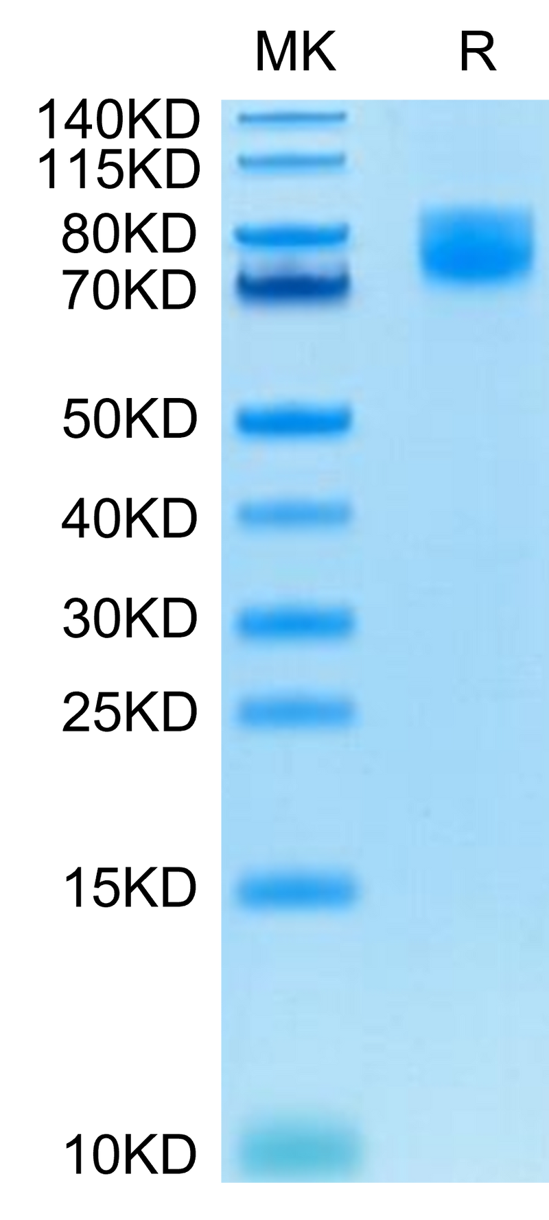 Human B7-2 on Tris-Bis PAGE under reduced condition. The purity is greater than 95%.