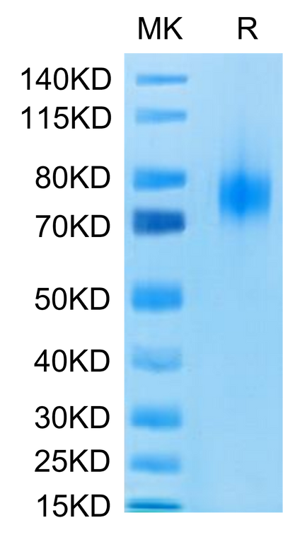 Human B7-1 on Tris-Bis PAGE under reduced condition. The purity is greater than 95%.