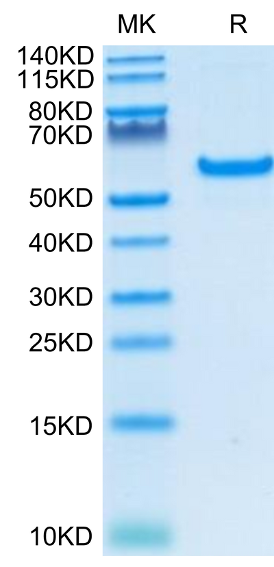 Human CD40 on Tris-Bis PAGE under reduced condition. The purity is greater than 95%.