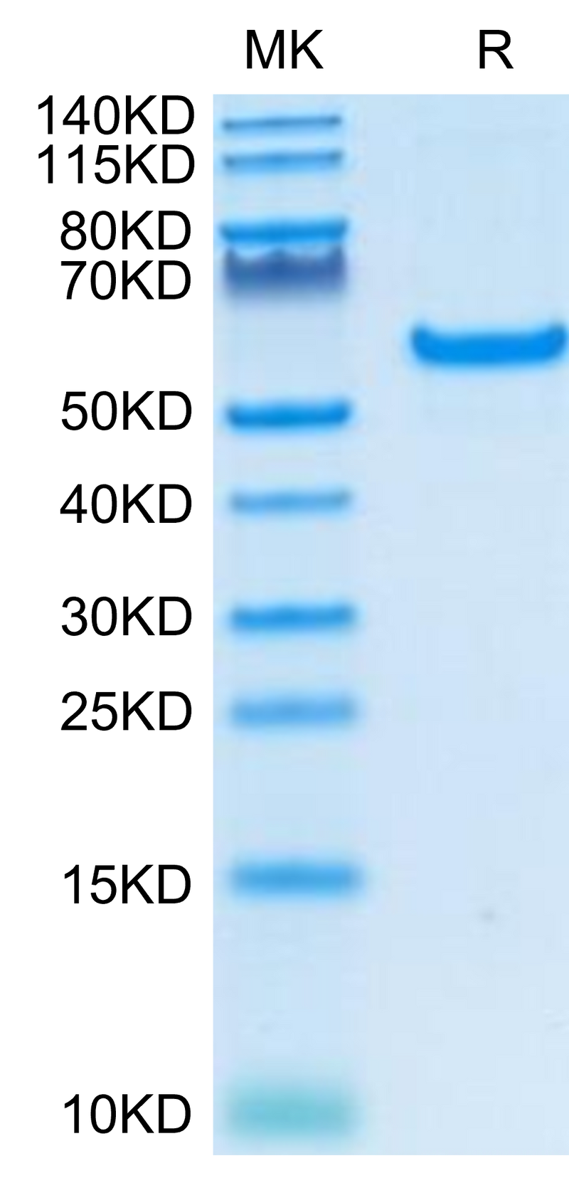 Human CD40 on Tris-Bis PAGE under reduced condition. The purity is greater than 95%.