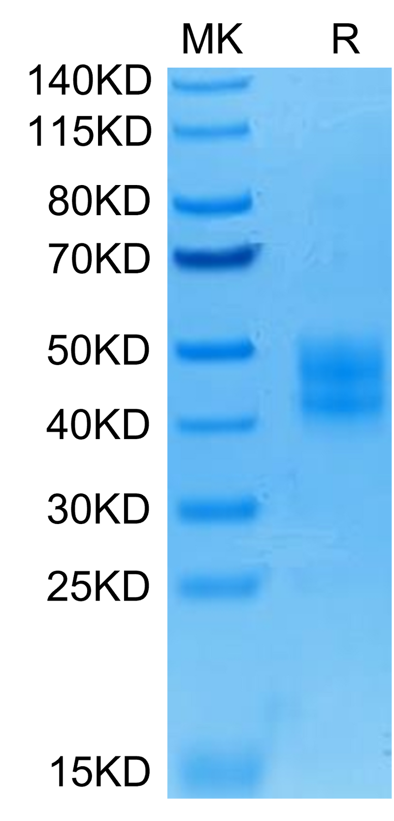 Human B7-H3 on Tris-Bis PAGE under reduced condition. The purity is greater than 95%.