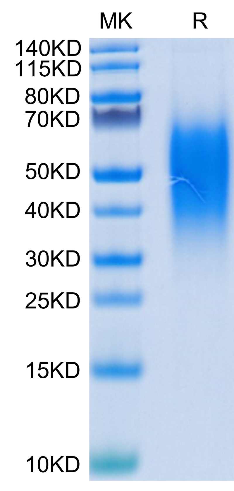 Human B7-H5 on Tris-Bis PAGE under reduced condition. The purity is greater than 95%.