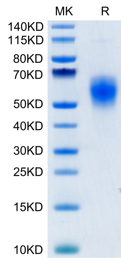 Human B7-H6 on Tris-Bis PAGE under reduced condition. The purity is greater than 95%.