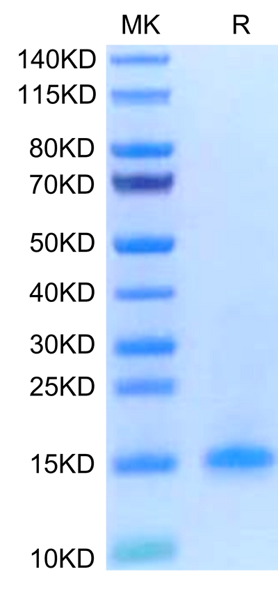 Human CD3 delta on Tris-Bis PAGE under reduced condition. The purity is greater than 95%.