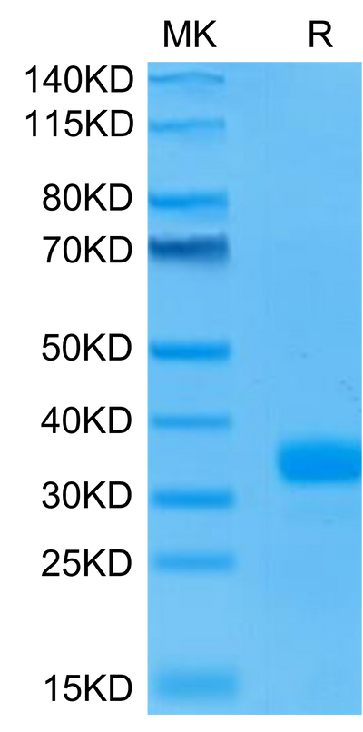 Human ANGPT2 on Tris-Bis PAGE under reduced condition. The purity is greater than 95%.