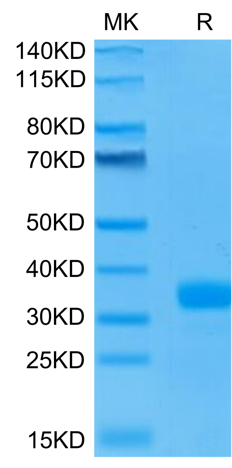 Human ANGPT2 on Tris-Bis PAGE under reduced condition. The purity is greater than 95%.