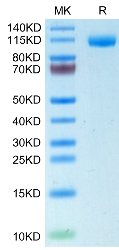 Human Siglec-2/CD22 on Tris-Bis PAGE under reduced condition. The purity is greater than 95%.