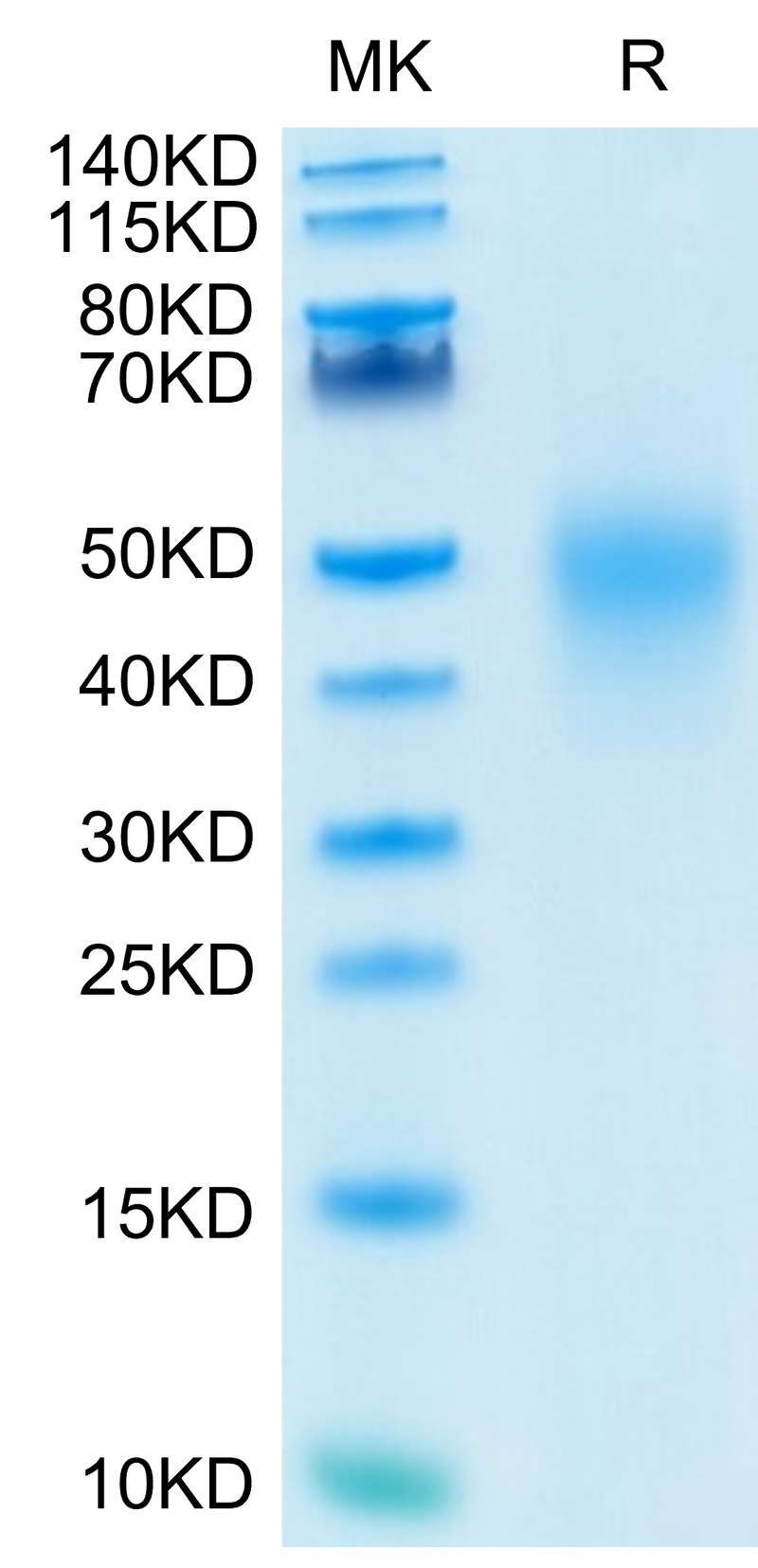 Human CD27 on Tris-Bis PAGE under reduced condition. The purity is greater than 95%.