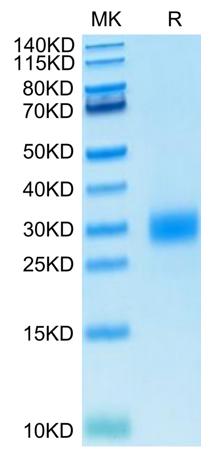 Human CTLA-4 on Tris-Bis PAGE under reduced condition. The purity is greater than 95%..