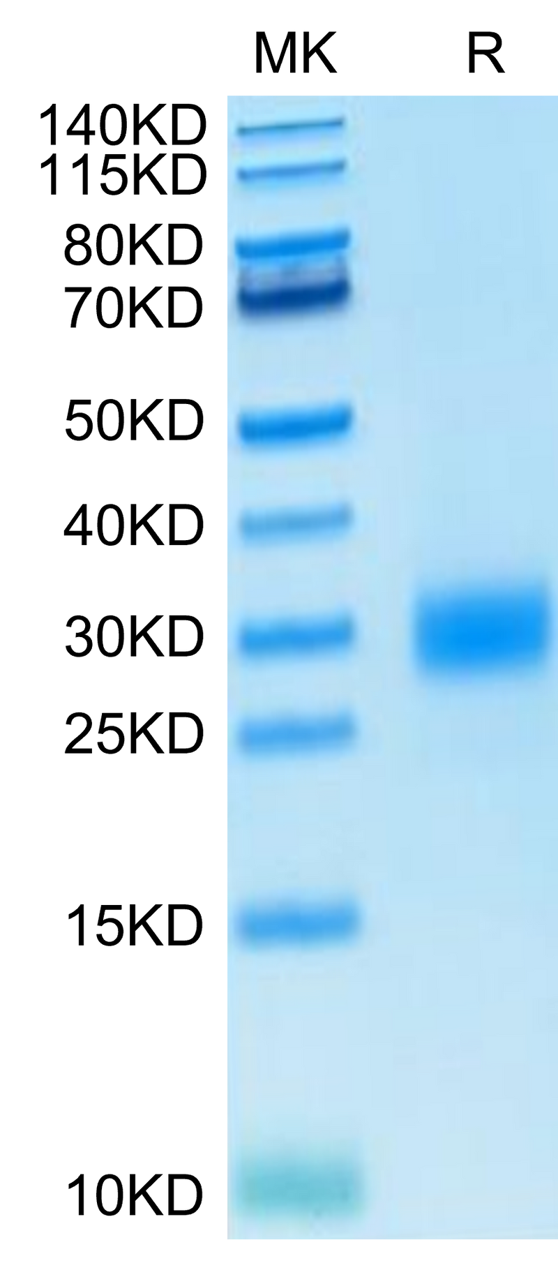 Human CTLA-4 on Tris-Bis PAGE under reduced condition. The purity is greater than 95%..