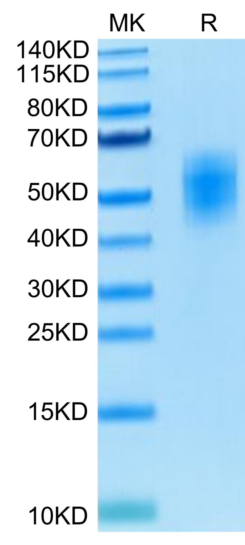 Human DNAM-1 on Tris-Bis PAGE under reduced condition. The purity is greater than 95%.