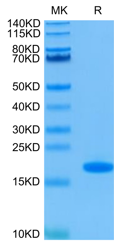 Human FGF basic on Tris-Bis PAGE under reduced condition. The purity is greater than 95%.