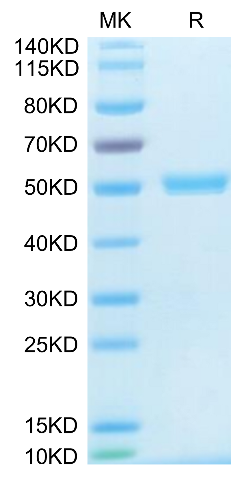 Human CD40 Ligand Trimer on Tris-Bis PAGE under reduced condition. The purity is greater than 95%.