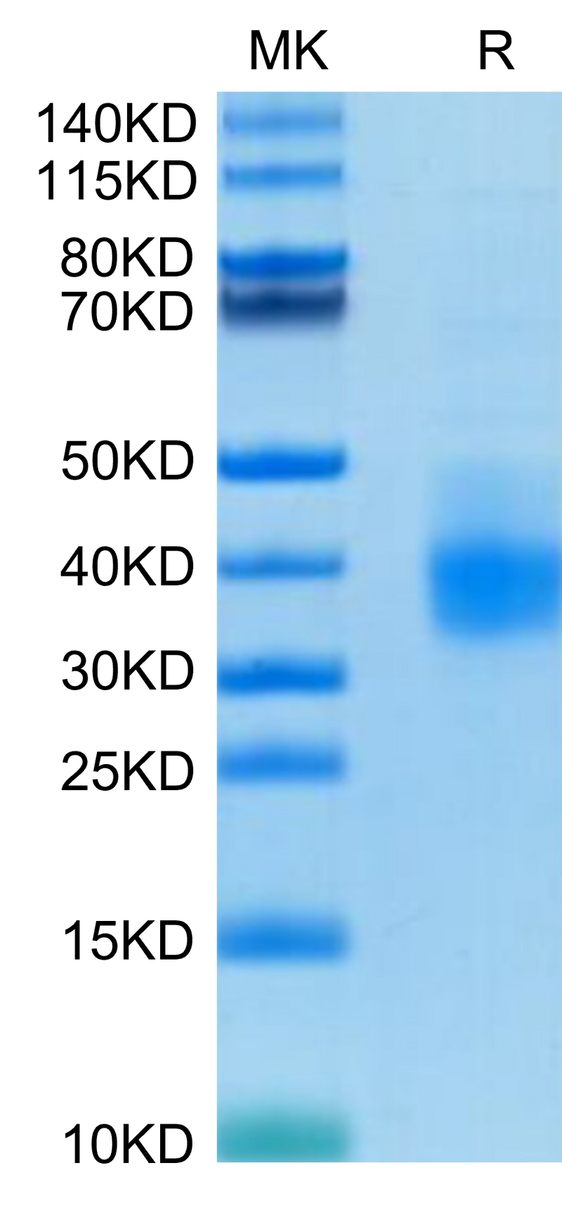 Human PD-L1 on Tris-Bis PAGE under reduced condition. The purity is greater than 95%.