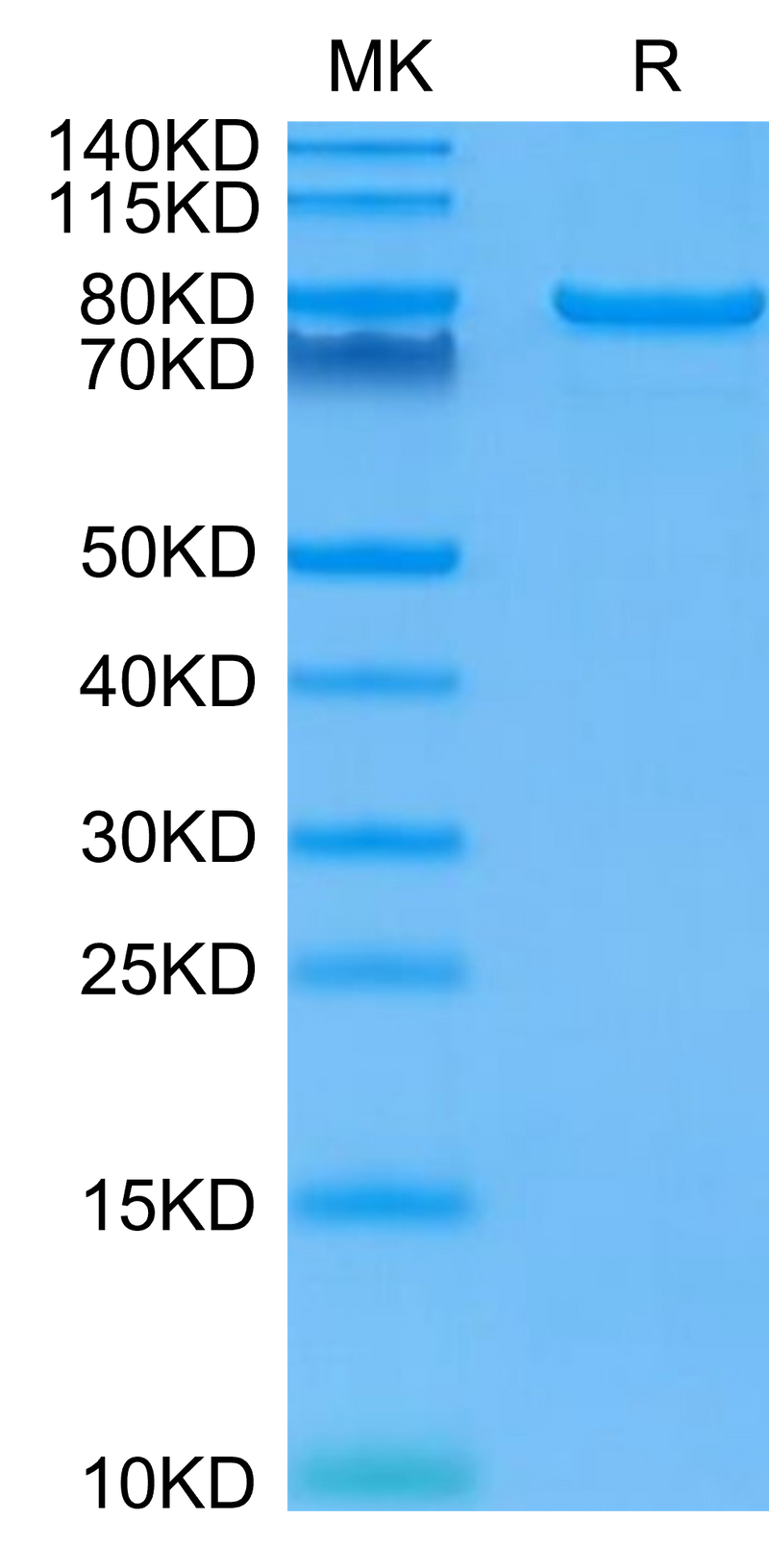 Human LAG3 on Tris-Bis PAGE under reduced condition. The purity is greater than 95%