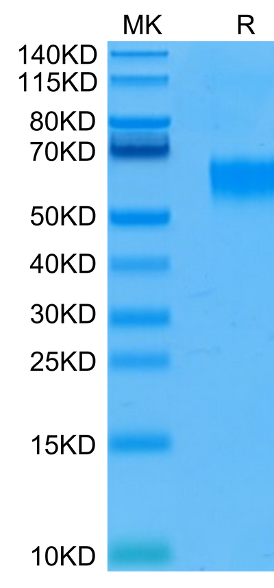 Human IL-3 R alpha on Tris-Bis PAGE under reduced condition. The purity is greater than 95%.