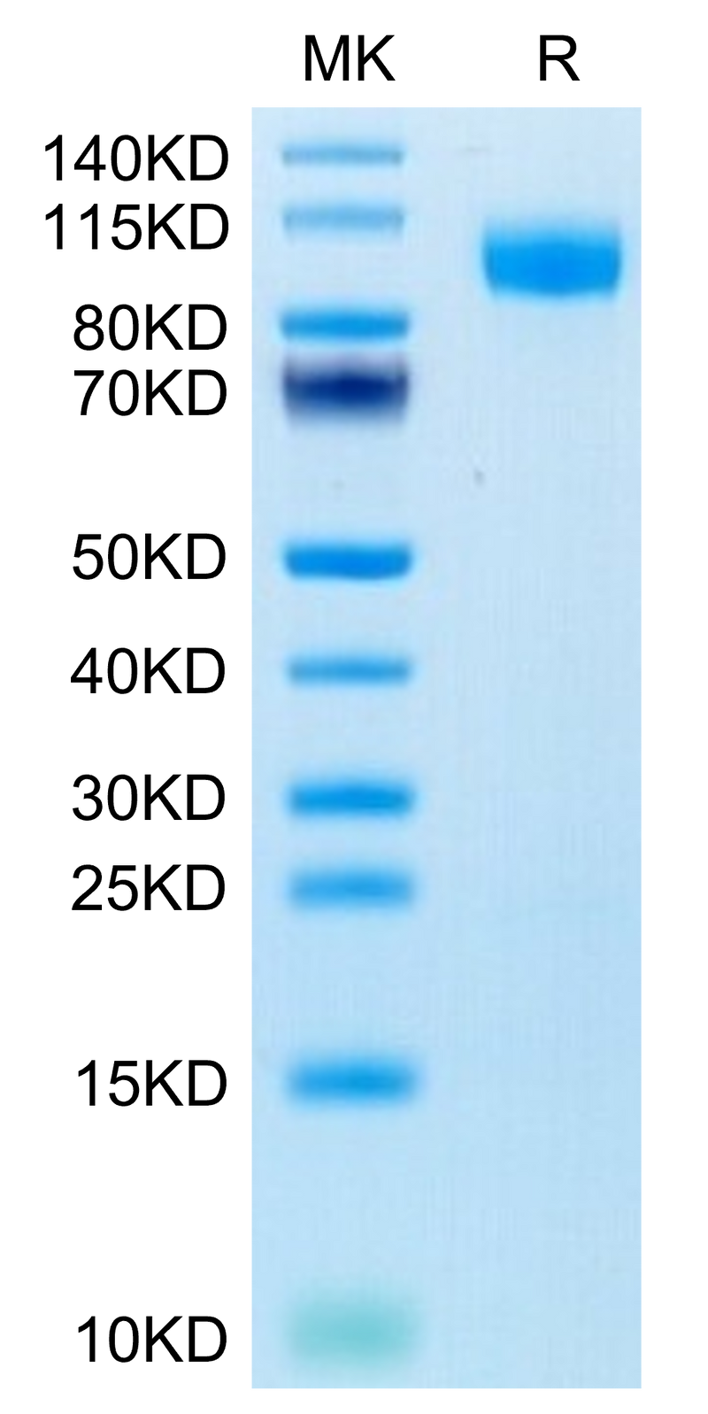 Human EGFR on Tris-Bis PAGE under reduced condition. The purity is greater than 95%.