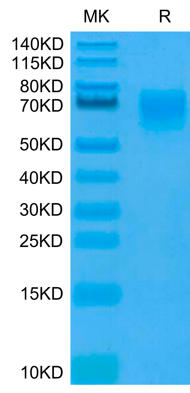 Human CD155 on Tris-Bis PAGE under reduced condition. The purity is greater than 95%.